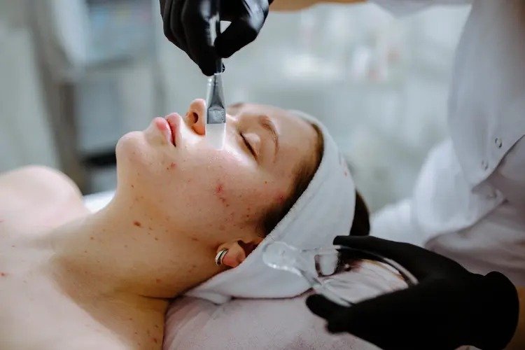 Clinical Acne Treatment