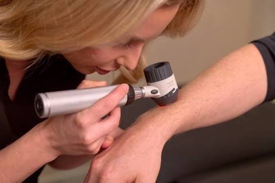 Dermoscopy Examination