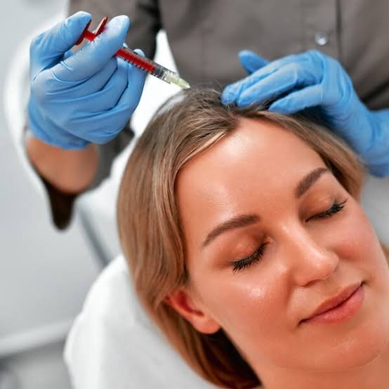 Platelet-Rich Plasma (PRP) for Hair