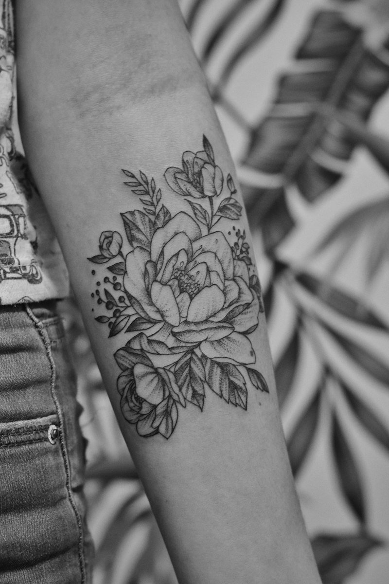 Precision Laser Tattoo Removal